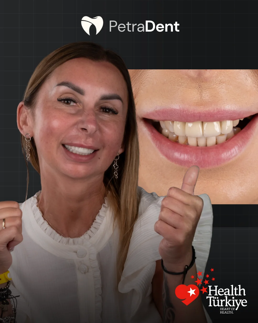 petradent case5 before after