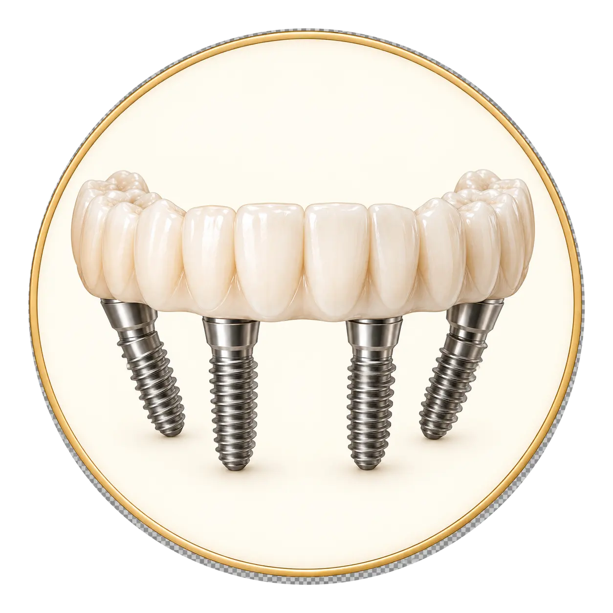 petradent full arch solutions circle transparent